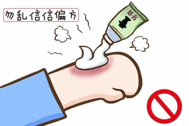 烧伤科信息简报 烧伤科信息简报