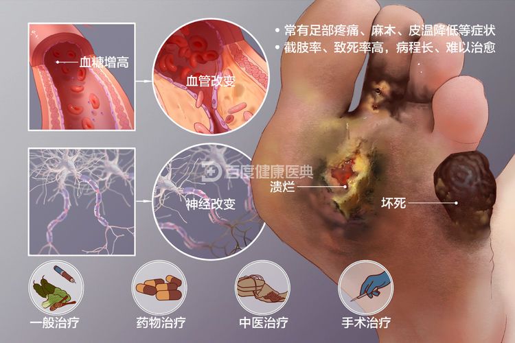 西安市九院内分泌科被授予“糖尿病足病诊疗中心” 西安市九院内分泌科被授予“糖尿病足病诊疗中心”