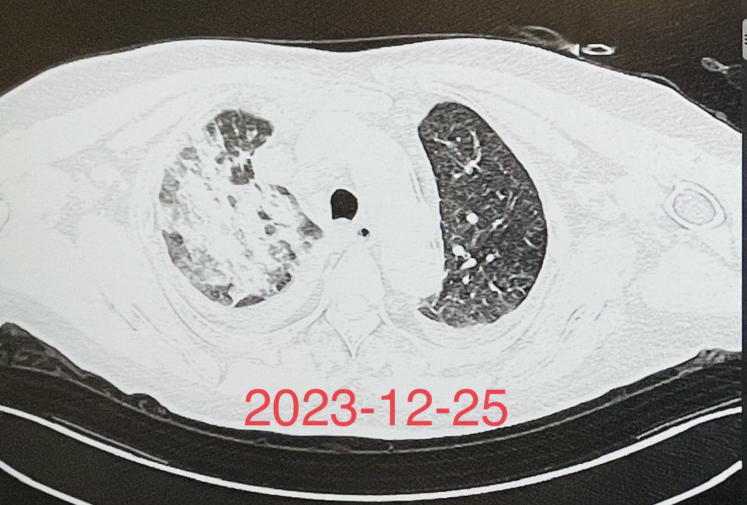 呼吸与危重症医学科,用心守护每一个生命! 呼吸与危重症医学科,用心守护每一个生命!