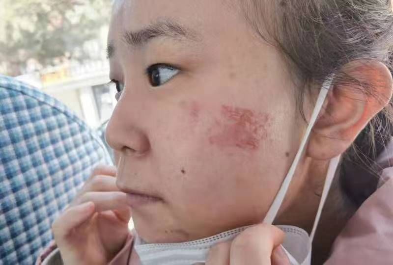 在阳光下——西安市第九医院驰援吉林抗疫纪实(四) 核酸采样八组 在阳光下——西安市第九医院驰援吉林抗疫纪实(四) 核酸采样八组