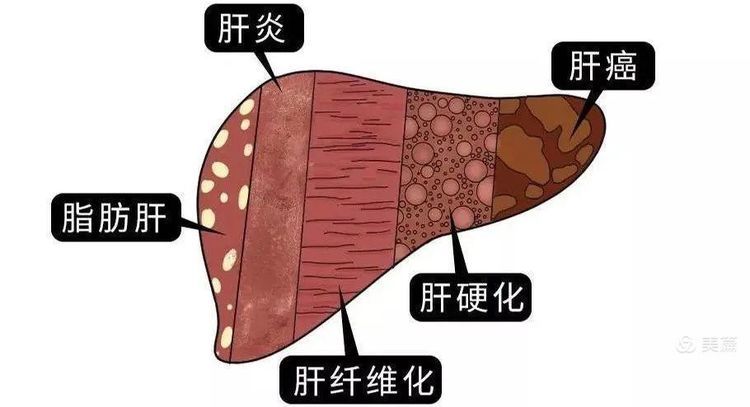 全国爱肝日义诊活动—呵护健康,“肝”心为你 全国爱肝日义诊活动—呵护健康,“肝”心为你