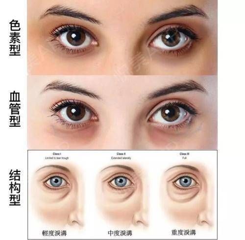 心血管病院——你,睡得好吗? 心血管病院——你,睡得好吗?