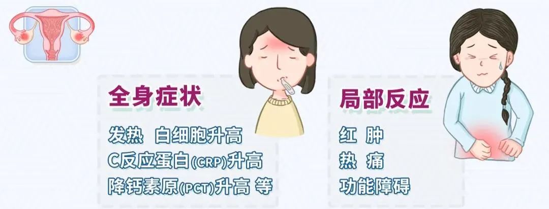 【科普园地】盆腔炎那些你不知道的事 【科普园地】盆腔炎那些你不知道的事