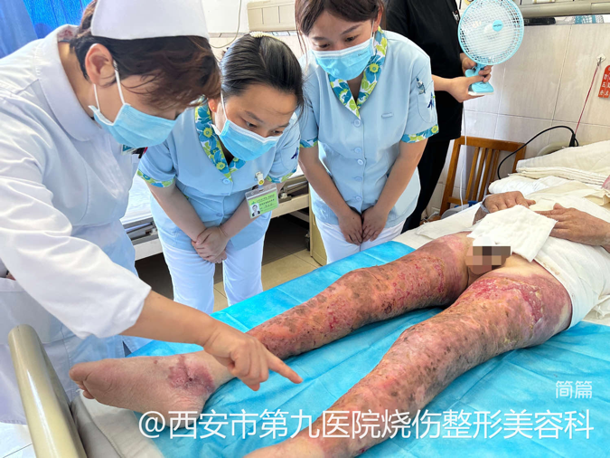 西安市第九医院烧伤整形美容科圆满完成西安EWMA国际伤口治疗师学校临床实习基地临床带教工作 西安市第九医院烧伤整形美容科圆满完成西安EWMA国际伤口治疗师学校临床实习基地临床带教工作