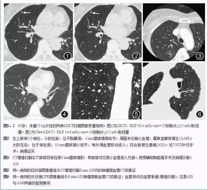 西安市第九医院最新引进的超高端CT已正式投入使用 西安市第九医院最新引进的超高端CT已正式投入使用