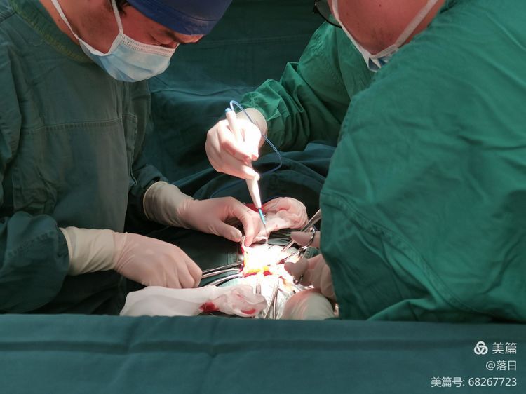 泌尿外科进行一腹股沟巨大疝修补术 泌尿外科进行一腹股沟巨大疝修补术