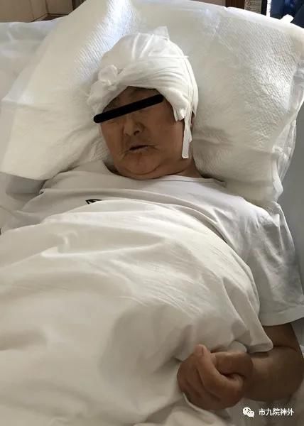 20小时的手术 20小时的手术
