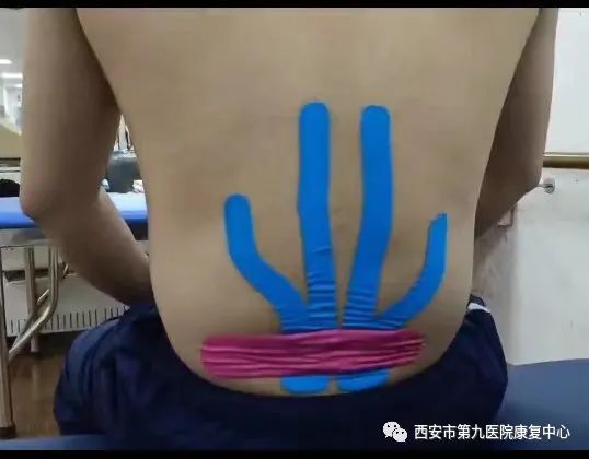 运动改善您的腰部酸痛! 运动改善您的腰部酸痛!