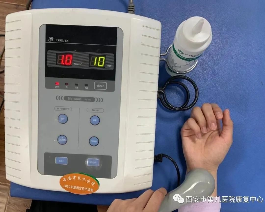 腕管综合征的康复治疗 腕管综合征的康复治疗