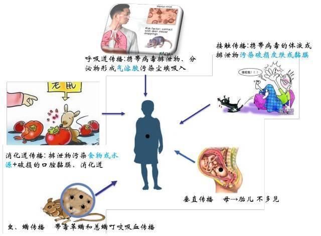恶心、呕吐、腹痛-也要警惕出血热! 恶心、呕吐、腹痛-也要警惕出血热!