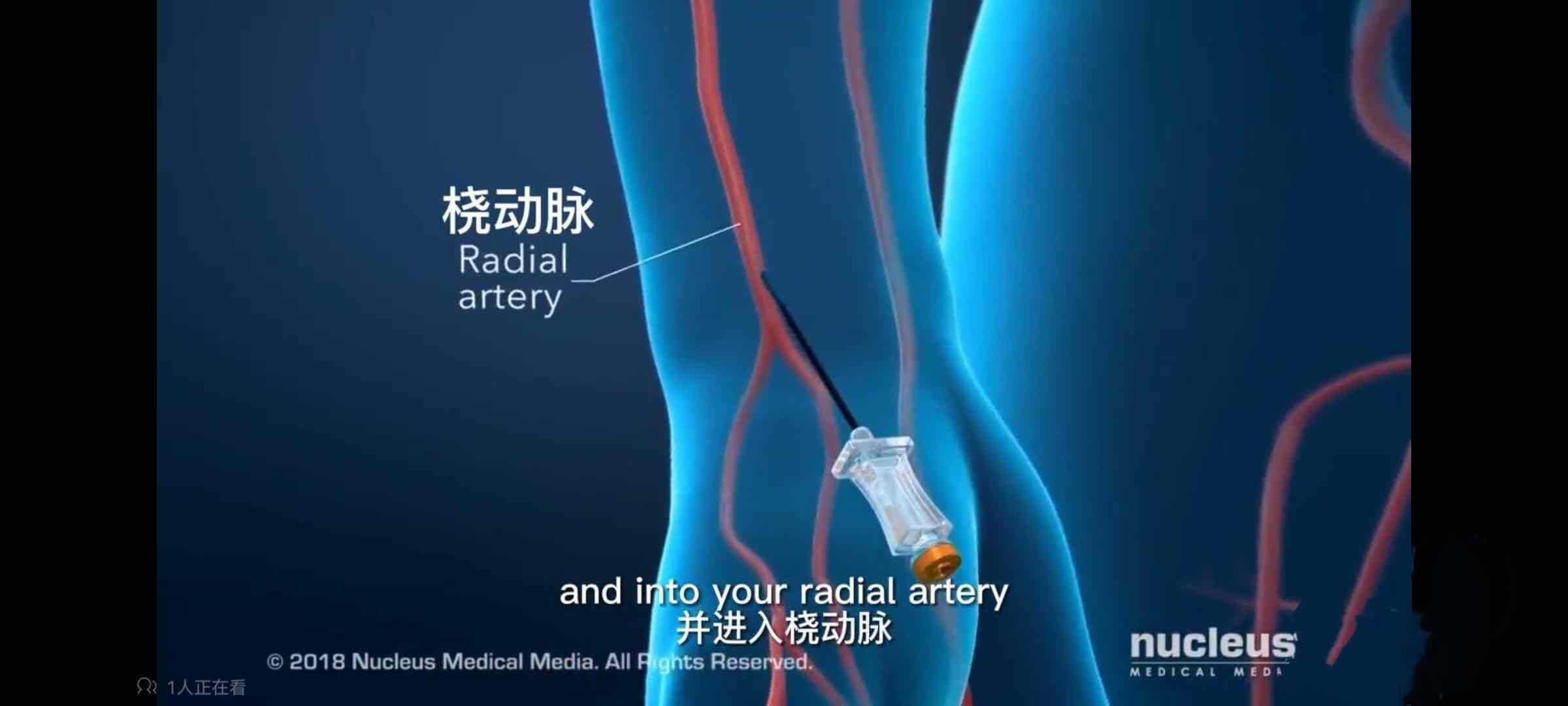 小小手指操,解决介入术后患者大问题 小小手指操,解决介入术后患者大问题