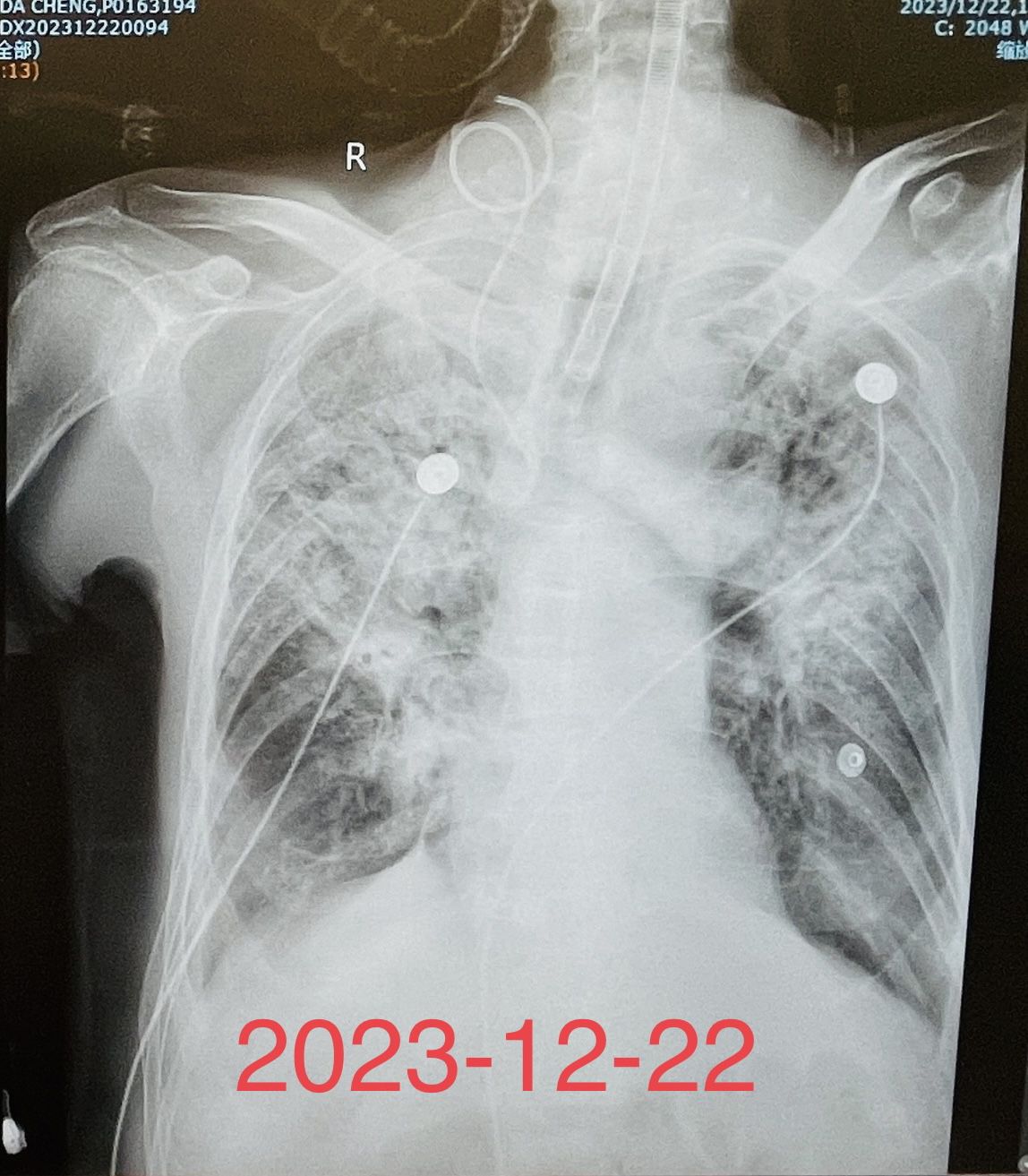 呼吸与危重症医学科,用心守护每一个生命! 呼吸与危重症医学科,用心守护每一个生命!