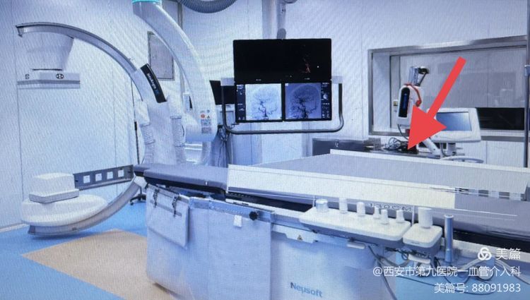 【血管介入科 】介入术中耗材保护的创新与临床应用 【血管介入科 】介入术中耗材保护的创新与临床应用