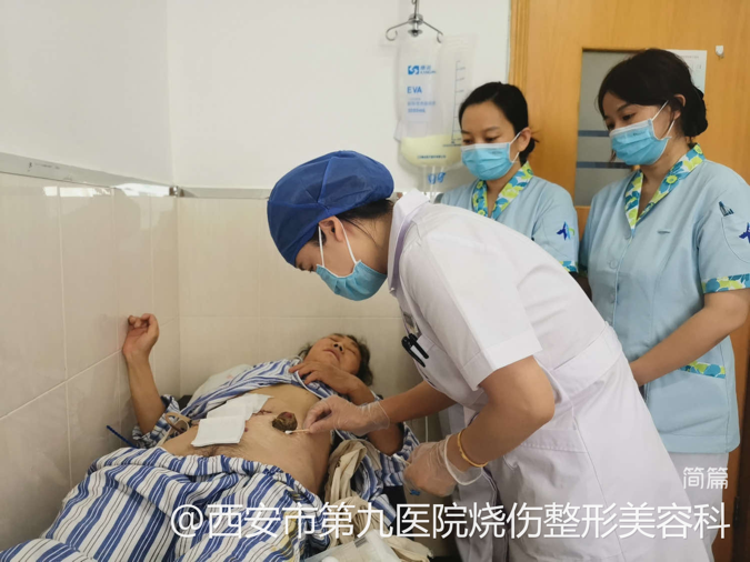 西安市第九医院烧伤整形美容科圆满完成西安EWMA国际伤口治疗师学校临床实习基地临床带教工作 西安市第九医院烧伤整形美容科圆满完成西安EWMA国际伤口治疗师学校临床实习基地临床带教工作