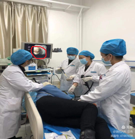 网篮在异物取出术中的应用 网篮在异物取出术中的应用