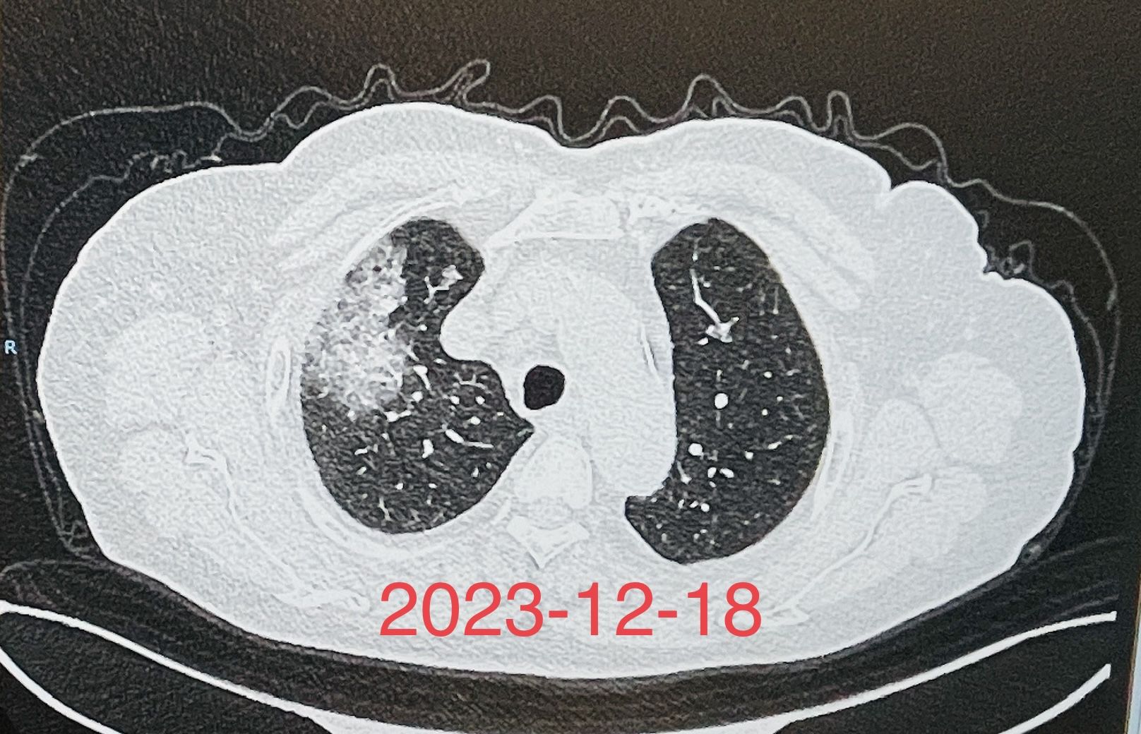 呼吸与危重症医学科,用心守护每一个生命! 呼吸与危重症医学科,用心守护每一个生命!