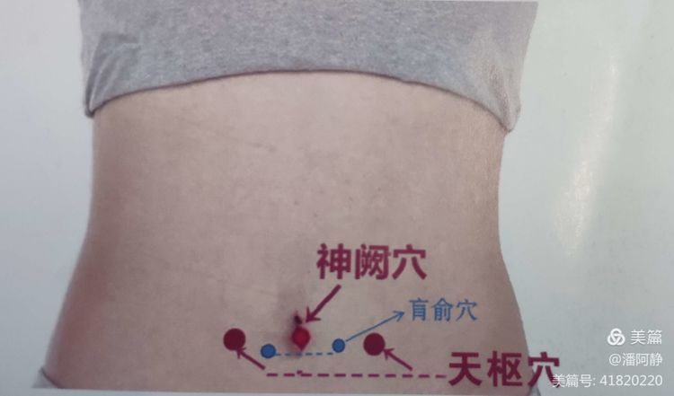 中西医结合体系化管理在老年髋部骨折便秘患者中的应用 中西医结合体系化管理在老年髋部骨折便秘患者中的应用