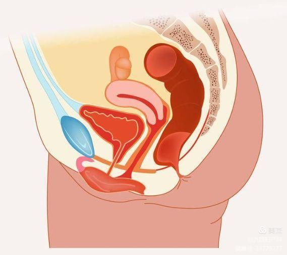 【特色技术】不同术式在阴道成形术中的应用 【特色技术】不同术式在阴道成形术中的应用